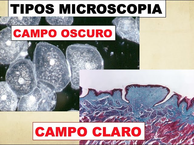 historia del microscopio de campo oscuro